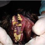 гипоплазия зубной эмали